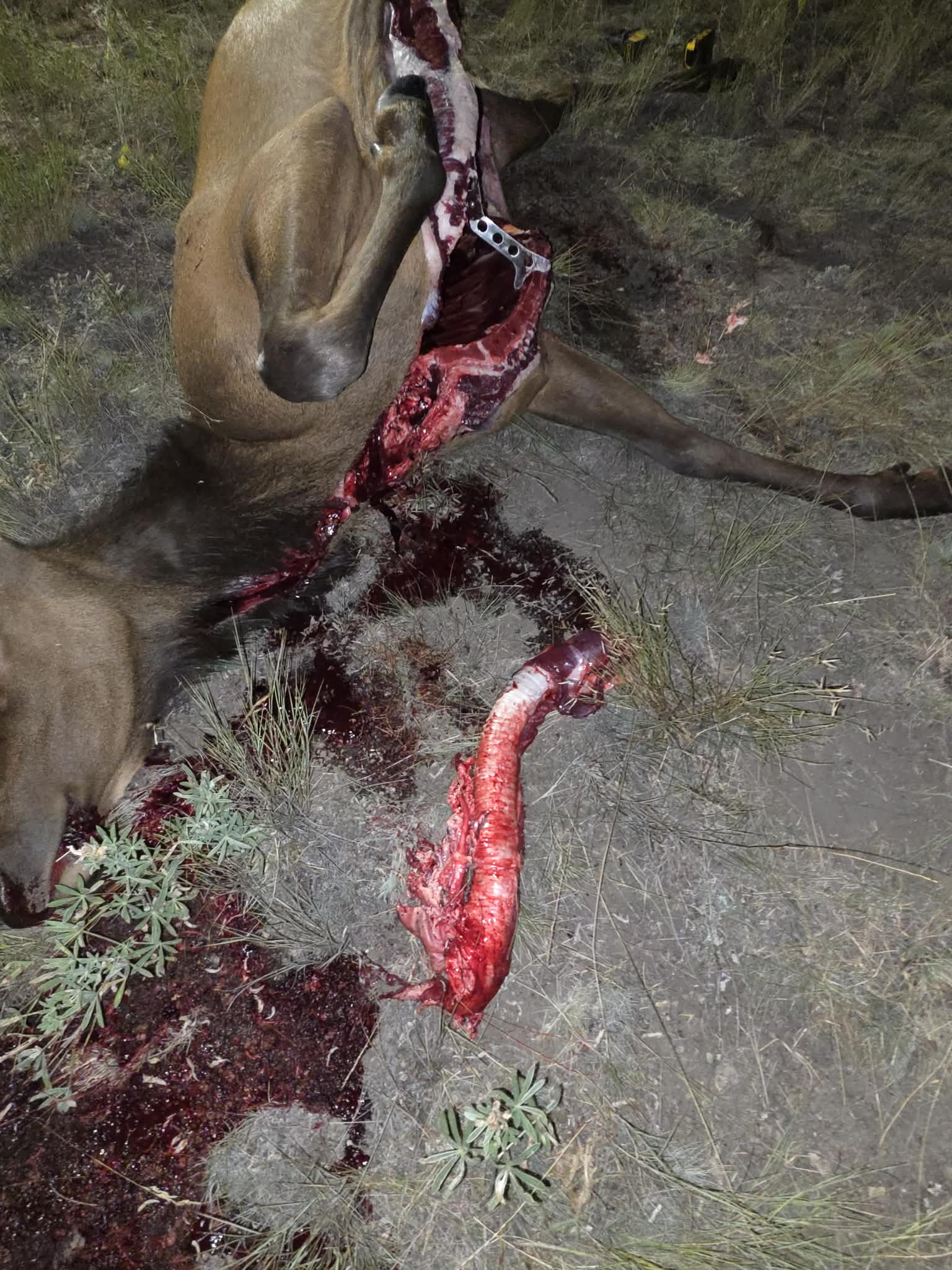 Esophagus Removed